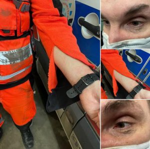 zdjęcia ratownika z rozerwanym rękawem i podbitym okiem - foto FB Wojewódzkie Pogotowie Ratunkowe w Katowicach